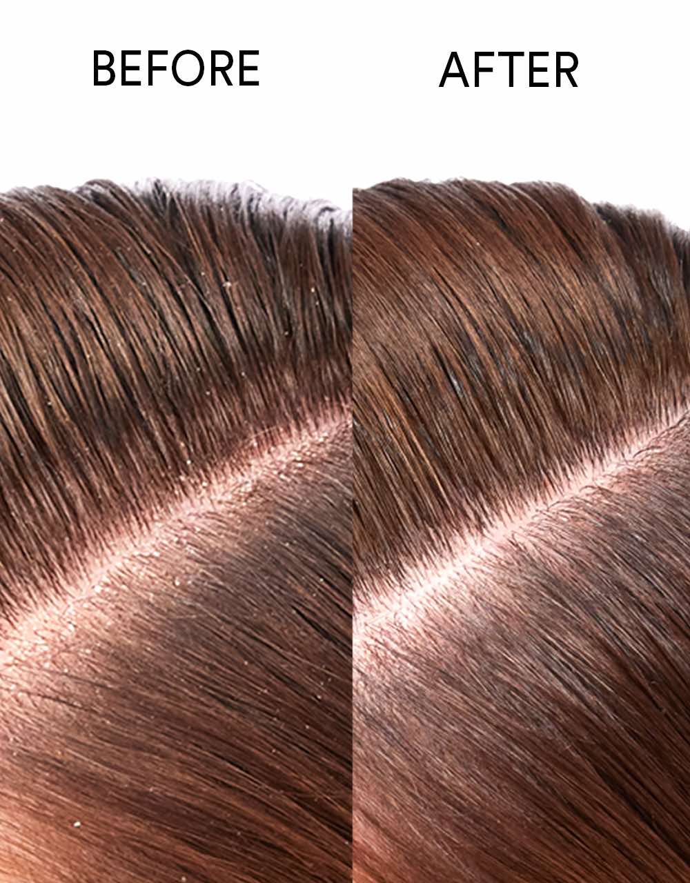 Pure Genius 98% Natural Scalp Restoring Oil